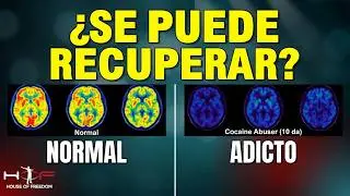 El Cerebro Adicto