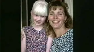 Albinism - The People the Challenge - Chapter 5