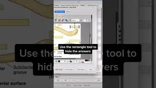 HOW TO STUDY ANATOMY: ANKI image occlusion
