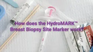 How the HydroMARK&trade; Breast Biopsy Site Marker Works