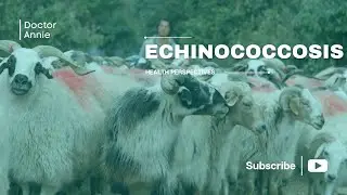 Episode 21 &ndash; Echinococcosis: The Hidden Danger of Parasitic Cysts
