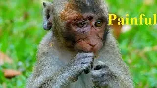Million Sad When Saw Poor Pity Orphan Jessie After Dolly Bite - Cameraman Help Clean Wound Betadin
