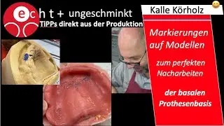 Totalprothetik-Modelle anzeichnen zur Optimierung der basalen Fl&auml;che nch der Fertigstellung.