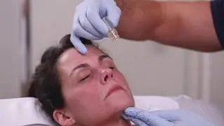 AquaGold Treatment by Dr. Pavlou