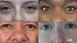 EMDR: Can these eye movements cure PTSD?