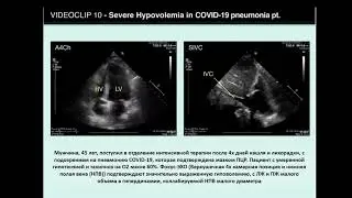 POCUS4COVID [ Добавочный файл 12 ] ВИДЕО 10