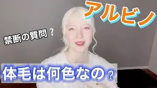 【アルビノの体毛について】質問多くいただくのでまとめました！！