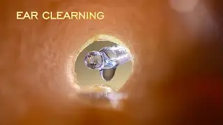 👂🏻ASMR EAR CLEARNING👂🏻 Ear peeling || Relaxing sounds💤💤💤