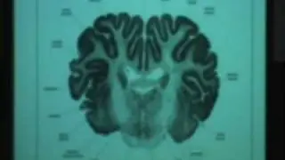Behavioral Neuroscience Lab, Lec 3, Psychology 116, UCLA