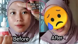 HANASUI PEELING SERUM | Peeling Serum Hanasui
