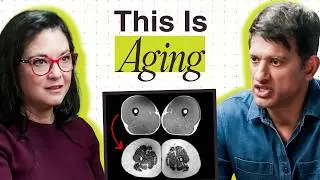 40 vs 70-Year-Old Muscles: What MRI Scans Reveal About Aging, Exercise, and Strength