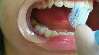 Técnica de cepillado Bass Modificada Albarran Flores Andrea 2OM42