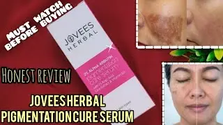 Jovees herbal pigmentation cure serum Review 2025 || serum for pigmentation blemishes dark spots