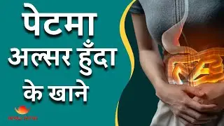 ulcer in stomach what to eat  | Ulcer Health Tips Nepali language |