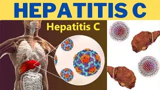Hepatitis C (HCV) - Is hepatitis C a blood-borne disease? | 247nht