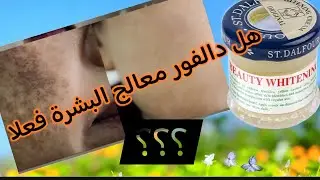 تتعاني من الكلف أقسم بالله جبت لك كريم الي غادي يهنيك من الكلف وتصبغات غادي تزياني وتصغاري 20سنة لور