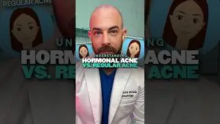 What&rsquo;s the difference between regular and hormonal acne? Derm explains! #hormonalacne