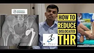 Hip Replacement Precautions | Do&rsquo;s & Don&rsquo;ts After Surgery #hipreplacement #hippain #physiotherapy 