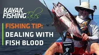 Getting Fish Blood Out of Your Clothing | Kayak Fishing Tip