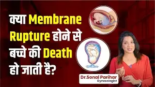 क्या membrane rupture होने से बचे की death हो&nbsp;जाती&nbsp;है&nbsp;? Sonal Parihar