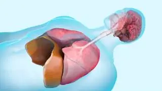 What Causes Sleep Apnea? | WebMD