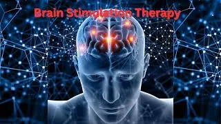 Brain Stimulation Therapy, a game changer