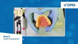 Clinical Provisional Crown and Bridge Workflow: Step 2, Tooth Preparation