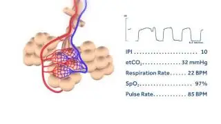 Medtronic Microstream Capnography In-Use Demonstration