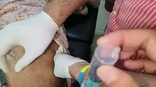 Hip joint pain#AVN#unable to walk#cured#dr.baljinder goniana mandi