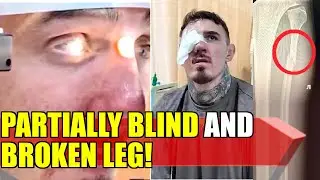 UFC 321 Broken Leg - Tom Aspinall PARTIALLY BLIND post UFC 321, Valter Walker REACT, Paddy Pimblett
