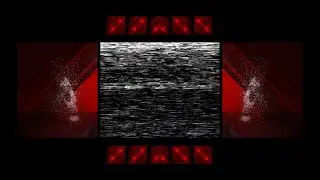IIVII - YOU DIE