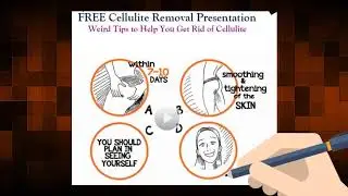 Get Rid of Cellulite   No Weight Loss No Gym Routine