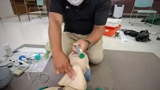 気管挿管（BURP法）