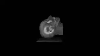 APoV | Computed Tomography Scan Datasets to Voxels Volume.