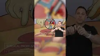 Dr. Rahal discusses &ldquo;Wild &lsquo;N Out&rdquo; star that passed away in Miami from Plastic Surgery! Part 3 of 3.