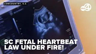 South Carolina Supreme Court to hear arguments challenging state's abortion ban