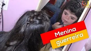 Menina com Síndrome de Apert luta contra o preconceito e sonha ser maquiadora