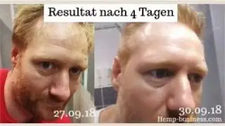 Erfahrungen Cannabis Beauty Sch&ouml;nheitsprodukte - Wirkung Hanf Kosmetik - Bibong Hemp Vitality Serum