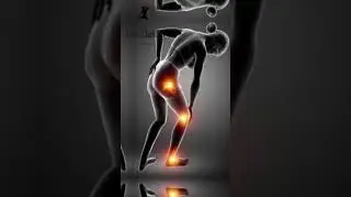 Jumping Jackson Testimony: How Jump Rope and Rebounding Transformed My Fitness Journey! #fitness