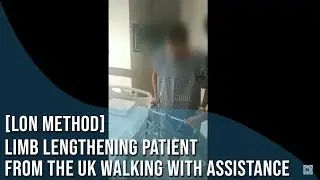 Limb lengthening patient from UK walking with assistance (LON method)