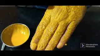 Natural home remedy/ face pack
