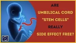 Are Umbilical Cord Stem Cells Really Side Effect Free?