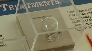 Fort Wilkins new exhibit on soldier illness now open