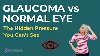 Glaucoma Eye vs Normal Eye: The Hidden Pressure You Can&rsquo;t See