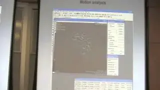 F-actin Dynamics in Human Skin Cells Directs Velocity of Cell Migration