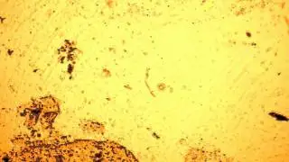 Comparaison de la taille de certains parasites