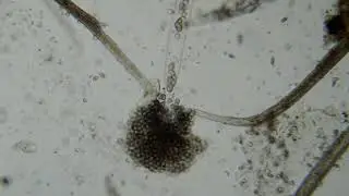 Выделение спорангиев водяной плесени HD