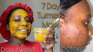 EMIGASO GYA TURMERIC POWDER KUMBALABE NE SKIN BALANCE
