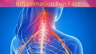 Inflammation Fun Facts! #shorts
