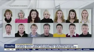 Face Blindness: Understanding Prosopagnosia and its effects